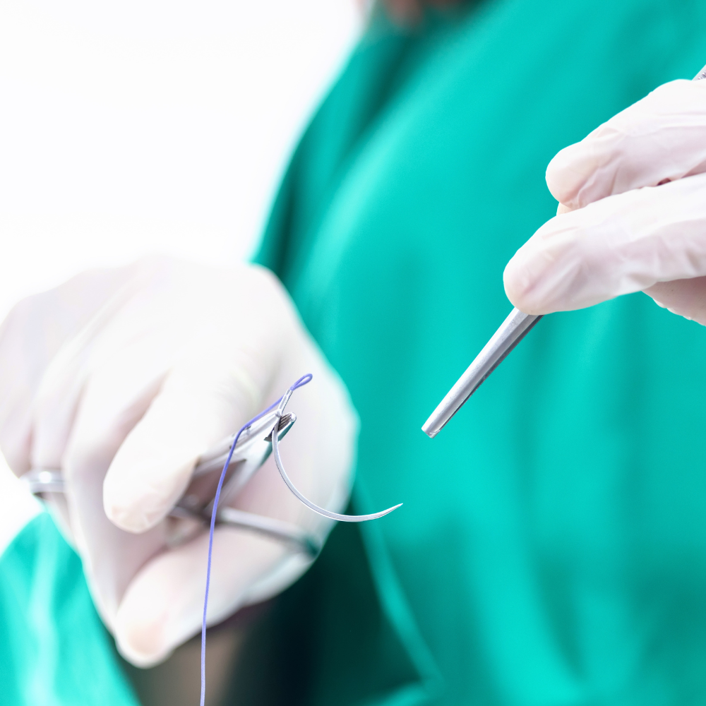 Monofiles oder polyfiles Nahtmaterial: Vor- und Nachteile im Überblick